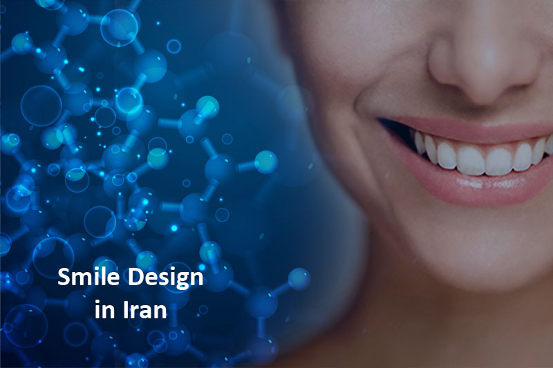 Smile Design
