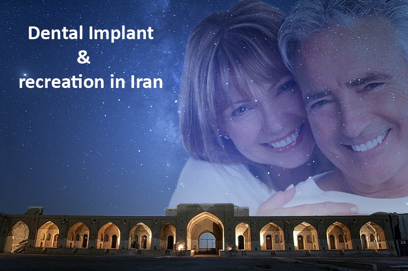 Dental Implant