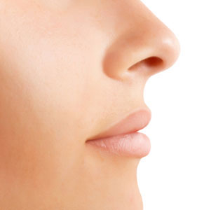 rhinoplasty