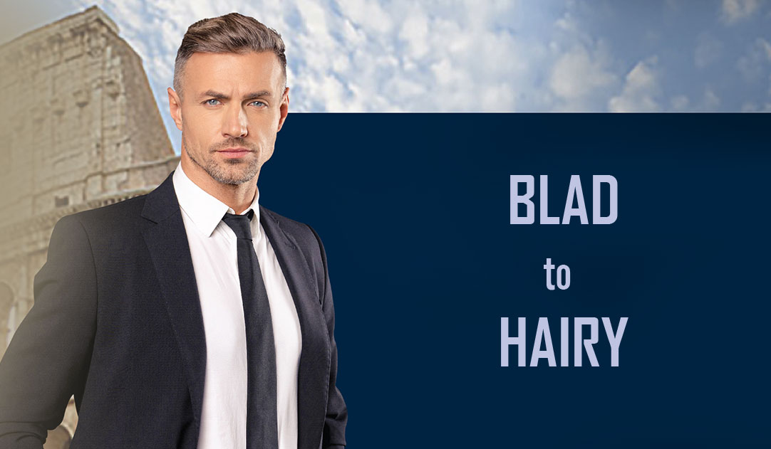 hair implant Enjoyable Iran